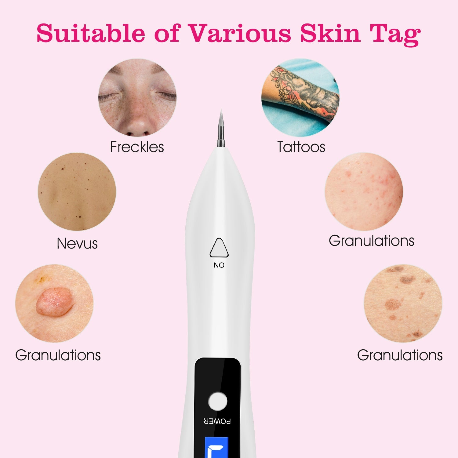 2 PCS Skin Tag Repair Kit Portable Beauty Equipment Multi-Level with Home Usage USB Charging LCD Level Adjustable 12 Replaceable Needles 266924-41
